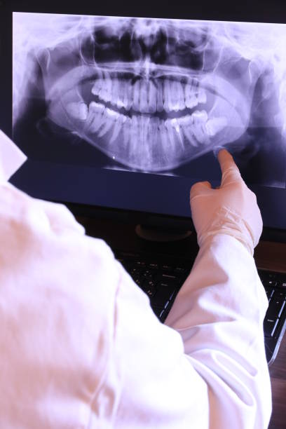 Best Emergency Dental Care for Broken or Chipped Teeth in Jackson, CA