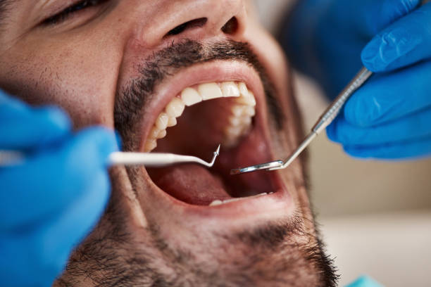 Best Emergency Root Canal Treatment in Jackson, CA